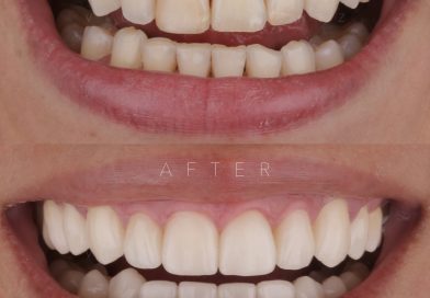 Comunicado Oficial de DENTAL CLONE: Advertencia sobre Suplantación de Identidad y Sitio Web Falso ‘dentalclonevictimas’».