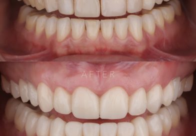 Comunicado Oficial de DENTAL CLONE: Advertencia sobre Suplantación de Identidad y Sitio Web Falso ‘dentalclonevictimas’».